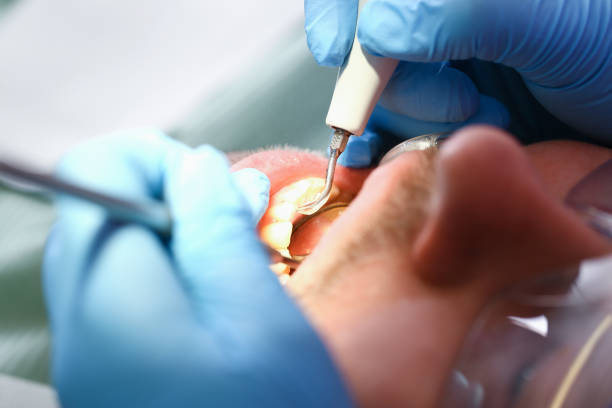 Best Emergency Wisdom Teeth Removal in Poth, TX