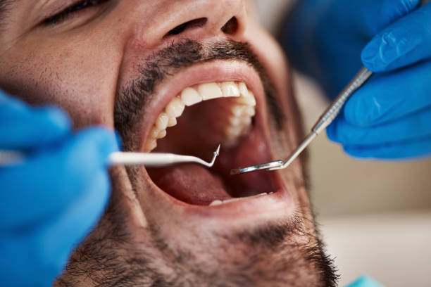 Best Emergency Root Canal Treatment in Poth, TX